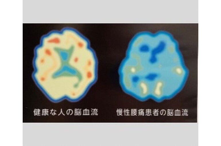 脳血流量
