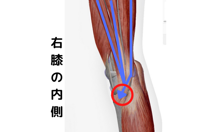 鵞足炎